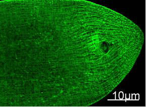 MYH1 (9C7) Mouse Monoclonal Antibody