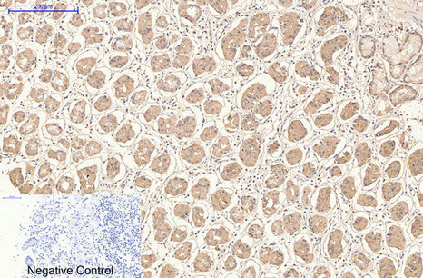 CD21 (3B1) Mouse Monoclonal Antibody