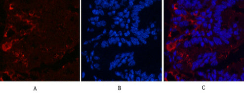 KIF7 (2A7) Mouse Monoclonal Antibody