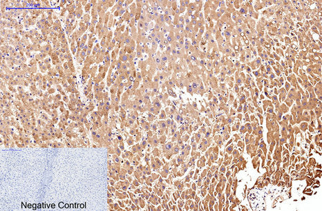 IL-2 Receptor alpha Mouse Monoclonal Antibody