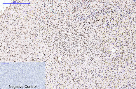 Progesterone Receptor (8H3) Mouse Monoclonal Antibody