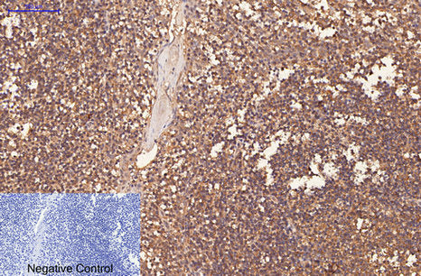 CD1a (4C3) Mouse Monoclonal Antibody