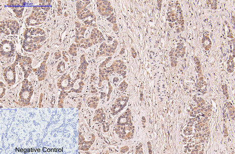CD5 (10F9) Mouse Monoclonal Antibody
