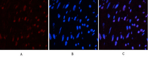 CD10 (7C7) Mouse Monoclonal Antibody