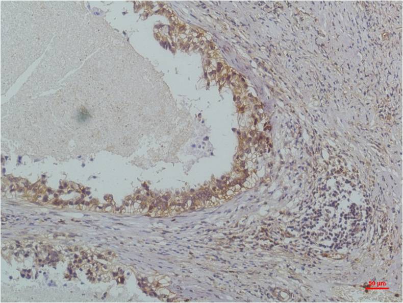 IKB beta (5H3) Mouse Monoclonal Antibody