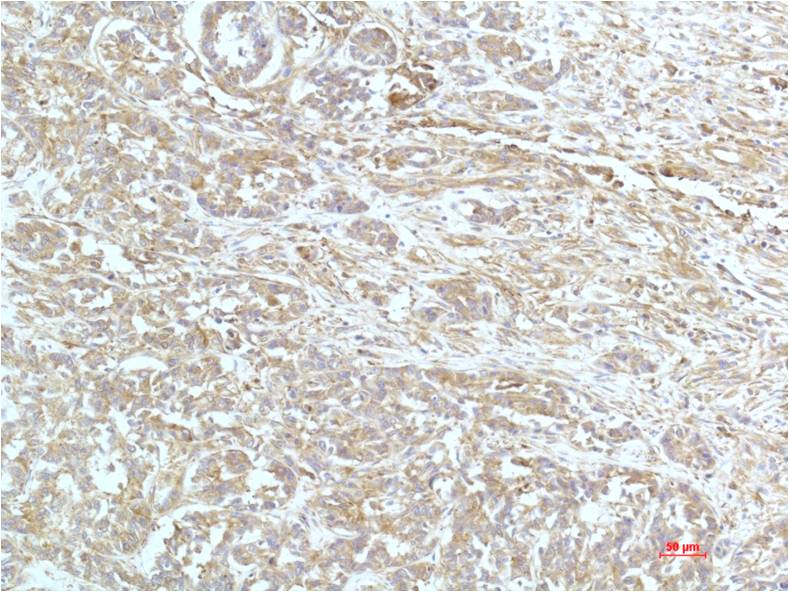 alpha Actinin (1A5) Mouse Monoclonal Antibody