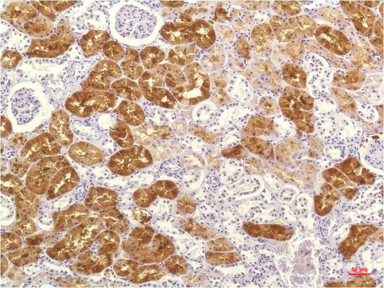 IL-8 (3A4) Mouse Monoclonal Antibody