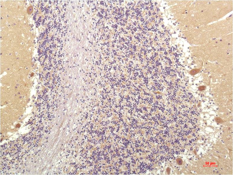 SGK1 (6E4) Mouse Monoclonal Antibody