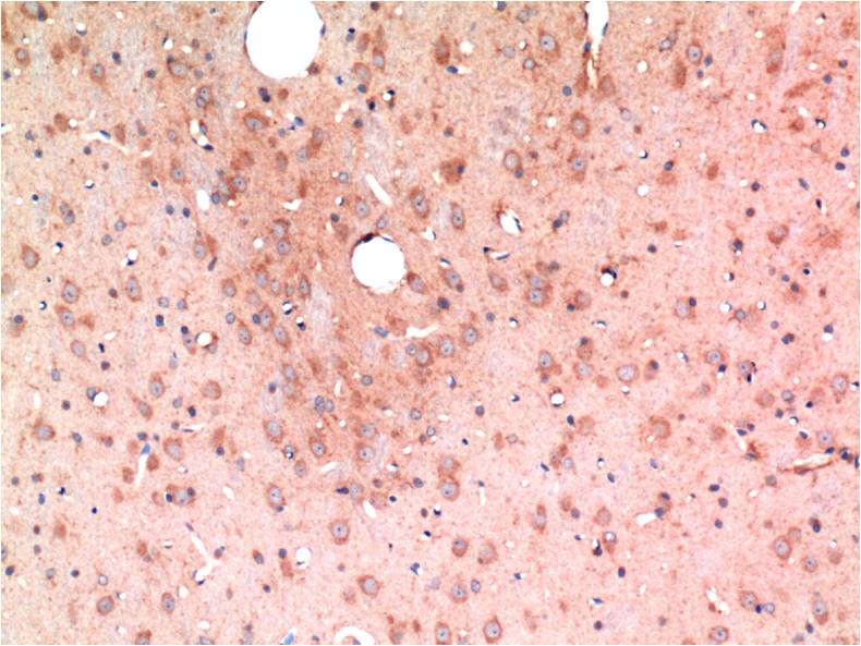 TGF beta 1 (4C1) Mouse Monoclonal Antibody