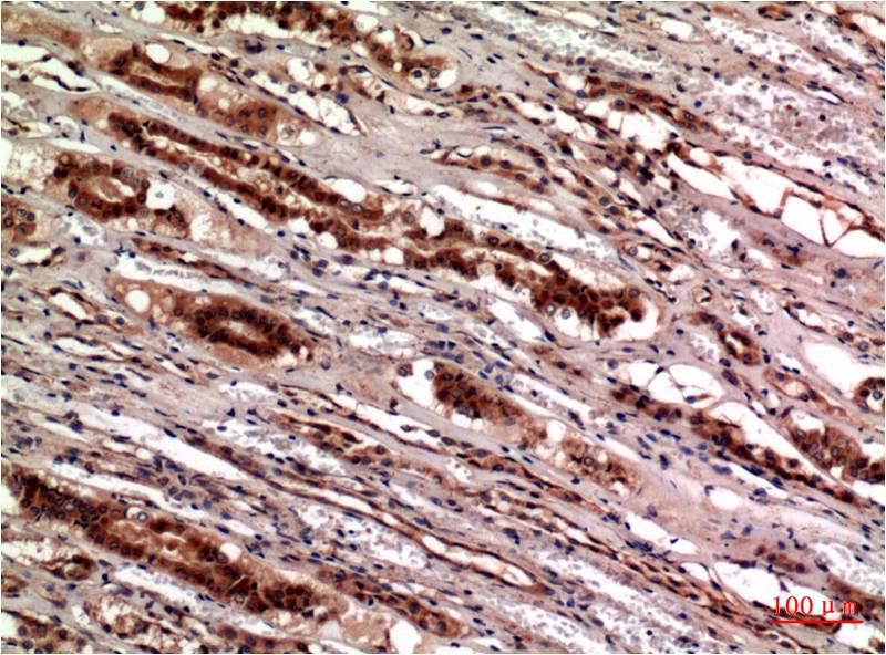 Cystatin C (7E3) Mouse Monoclonal Antibody