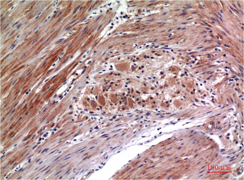 Phospho-ERK1/2 (Tyr222/Tyr205) (1H4) Mouse Monoclonal Antibody