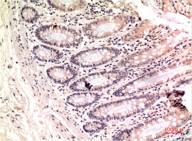 gamma Tubulin (8H4) Mouse Monoclonal Antibody