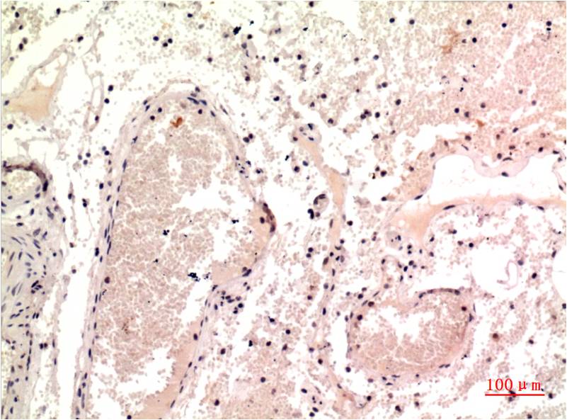 gamma Tubulin (9B5) Mouse Monoclonal Antibody