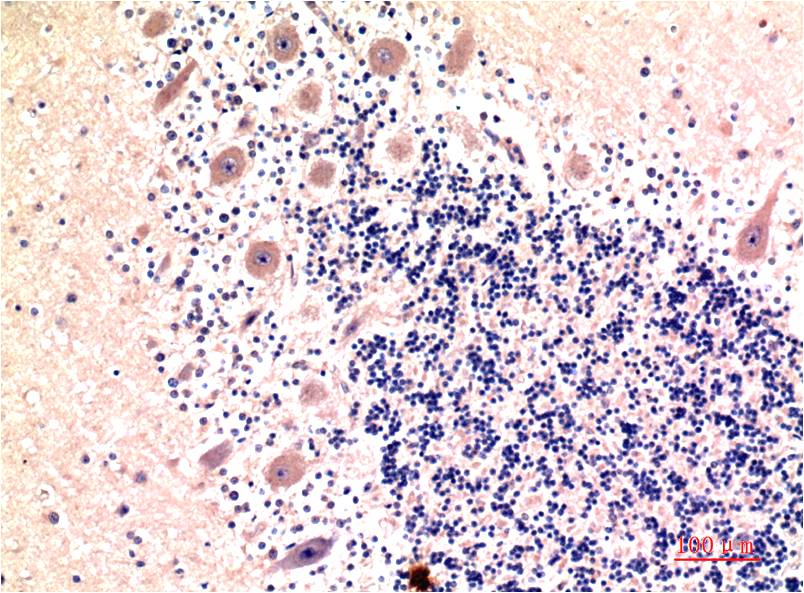 LC3B (8H6) Mouse Monoclonal Antibody