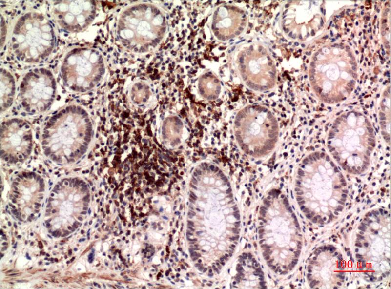 epsilon Tubulin (4C4) Mouse Monoclonal Antibody