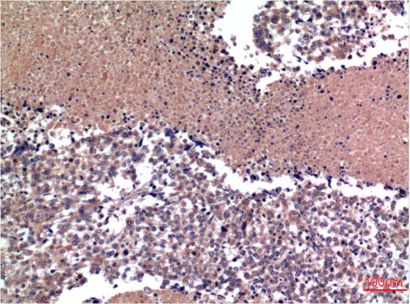 Cyclin B1 (1B3) Mouse Monoclonal Antibody