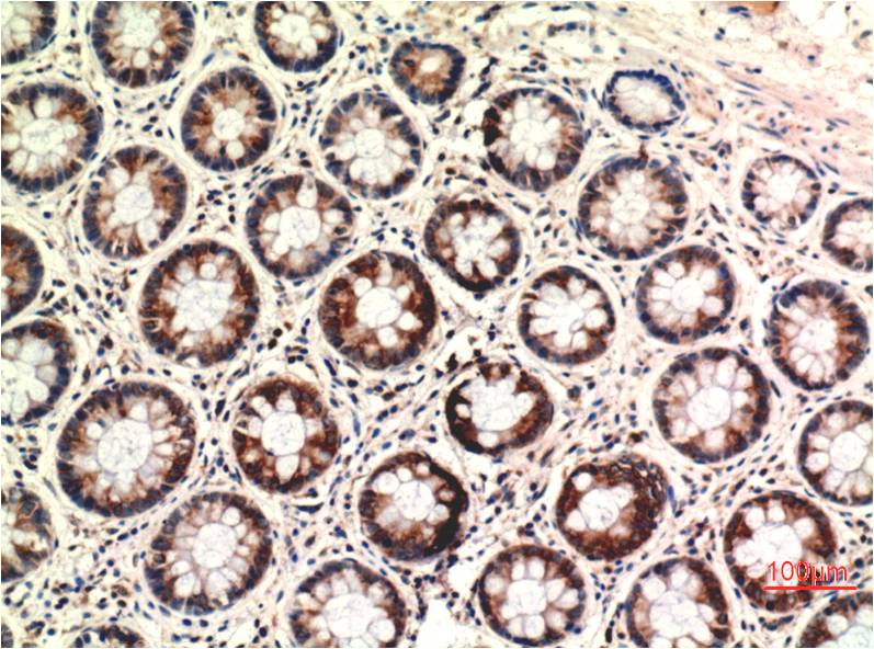 PTEN (7H2) Mouse Monoclonal Antibody