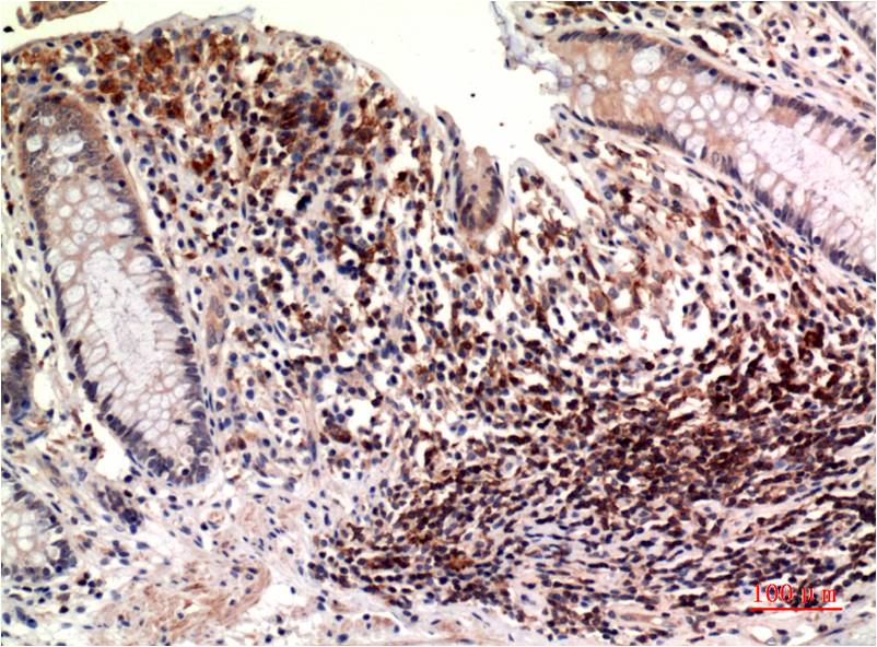 epsilon Tubulin (7D3) Mouse Monoclonal Antibody