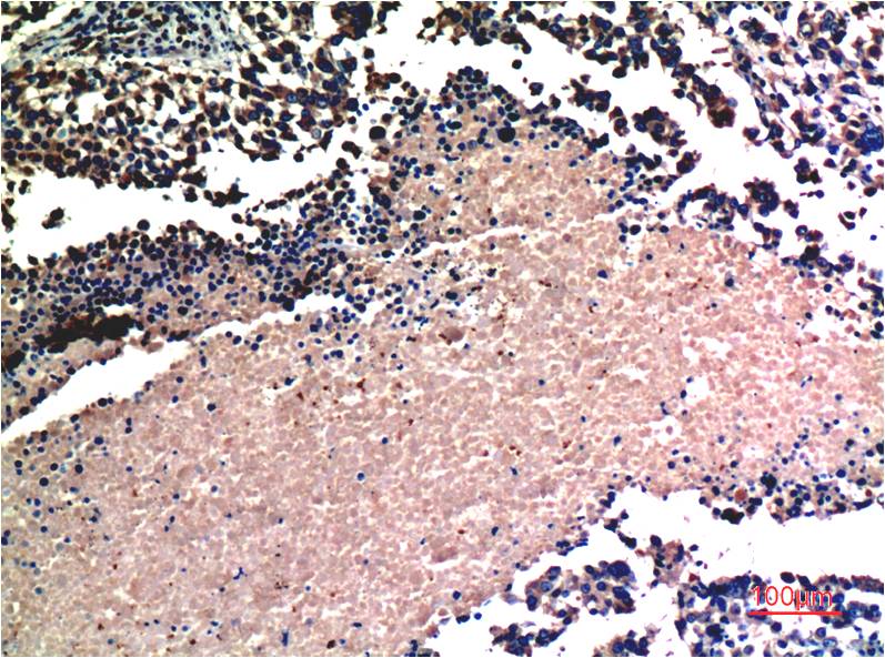 AKT (2A1) Mouse Monoclonal Antibody
