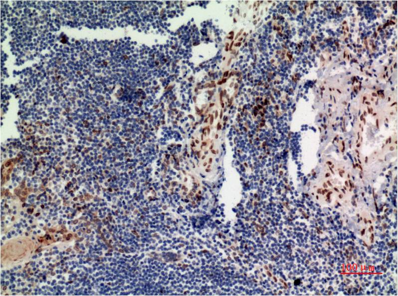 ERK1 (1D10) Mouse Monoclonal Antibody