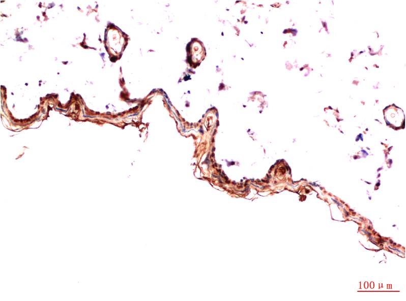 PDGFR alpha (7H6) Mouse Monoclonal Antibody