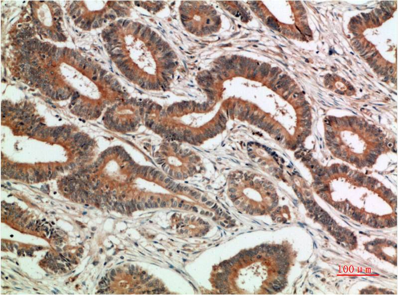 c-Jun (10G2) Mouse Monoclonal Antibody
