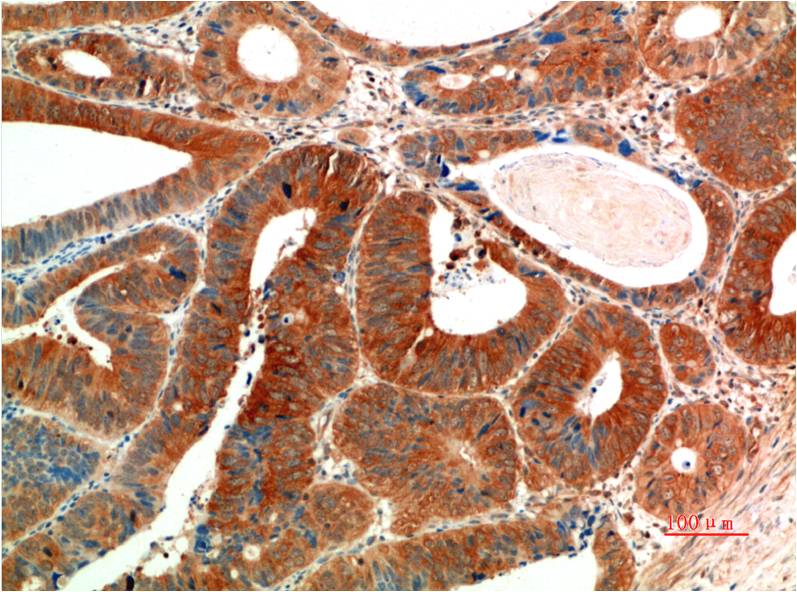 Phospho-ERK1/2 (Tyr222/Tyr205) (10C8) Mouse Monoclonal Antibody