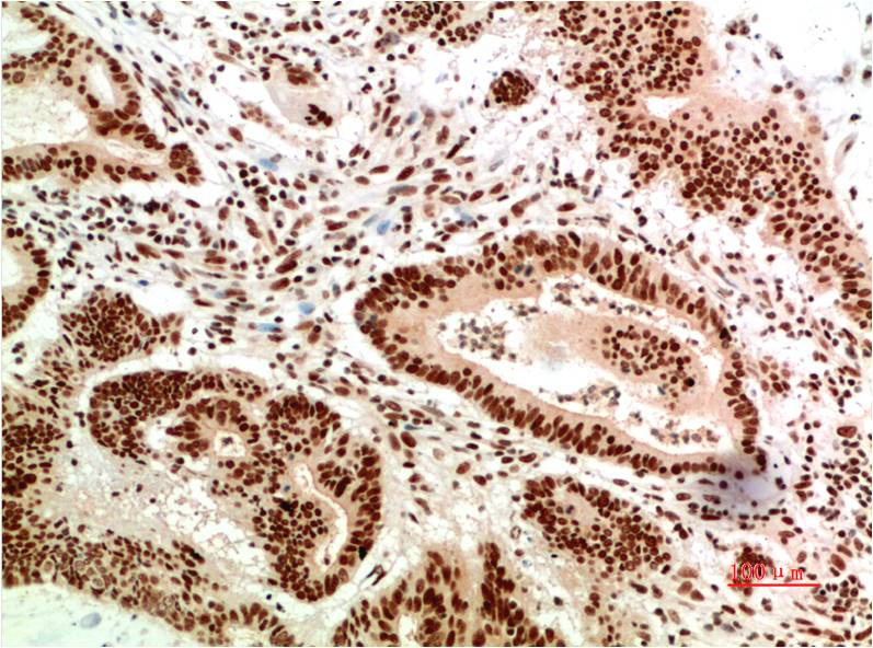 ATM (9F7) Mouse Monoclonal Antibody
