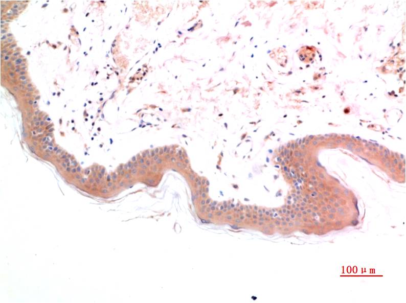 Phospho-Smad3 (Ser425) (7H6) Mouse Monoclonal Antibody