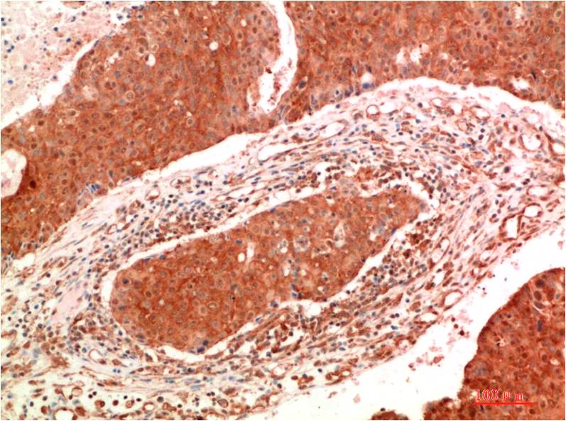 JAK2 (6B4) Mouse Monoclonal Antibody
