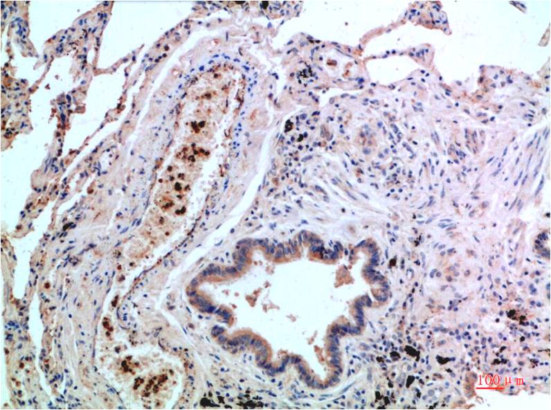 p38 (6F5) Mouse Monoclonal Antibody