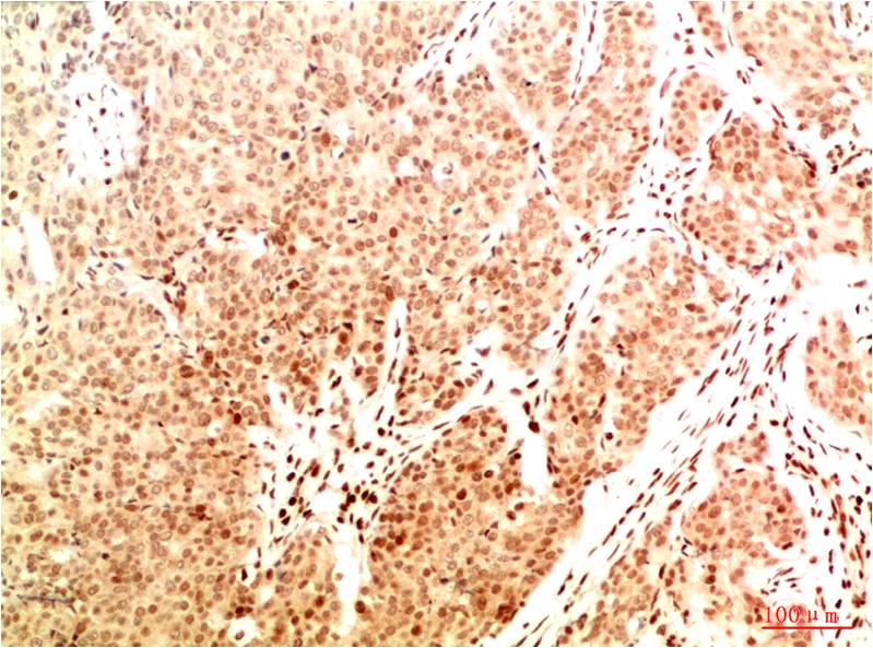 Acetyl-NF-KB p65 (Lys314/Lys315) (5F4) Mouse Monoclonal Antibody