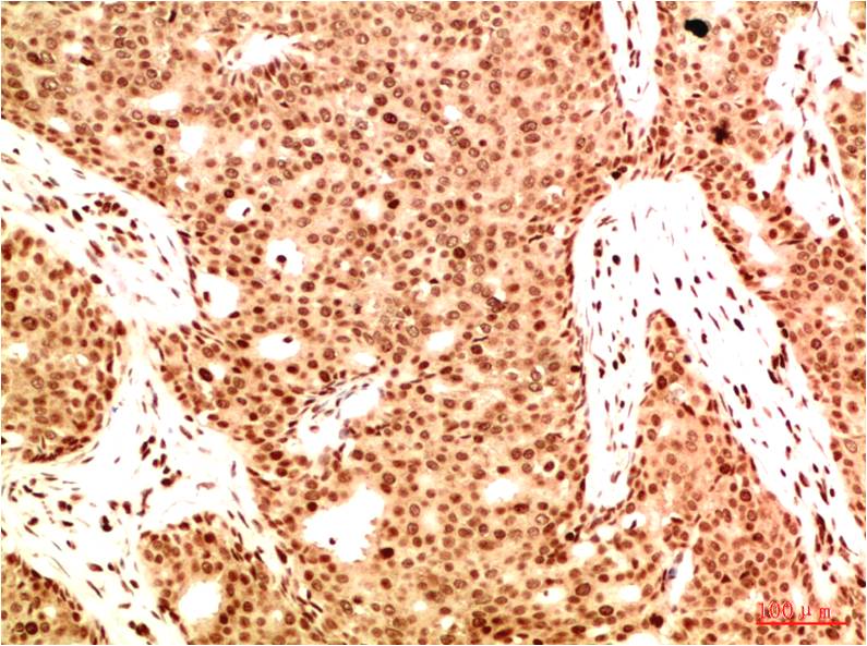 Acetyl-NF-KB p65 (Lys314/Lys315) (6D6) Mouse Monoclonal Antibody