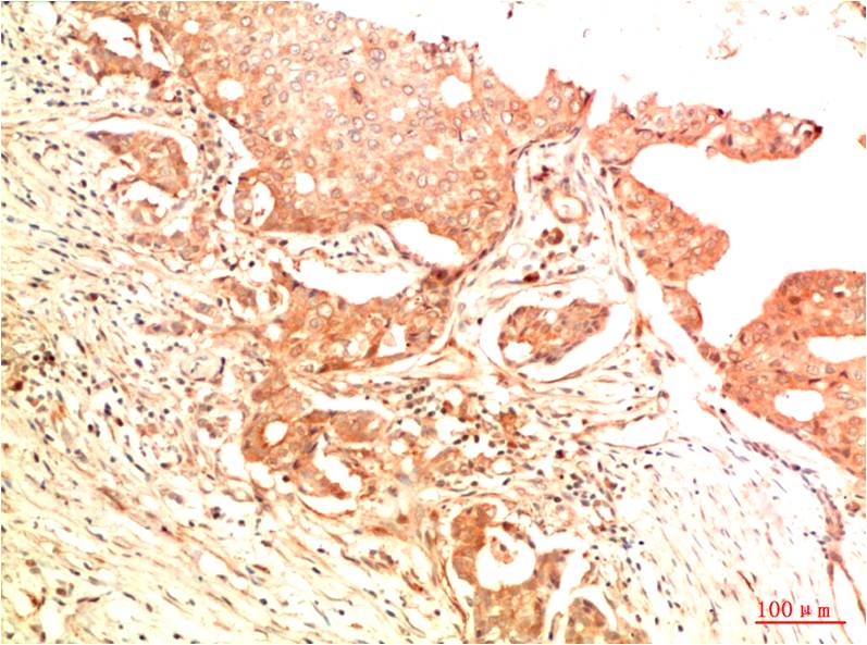 Acetyl-p53 (Lys382) (7E1) Mouse Monoclonal Antibody