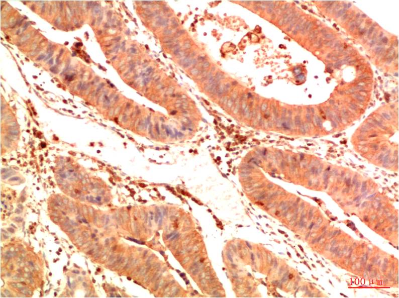 Acetyl-p53 (Lys382) (3E3) Mouse Monoclonal Antibody
