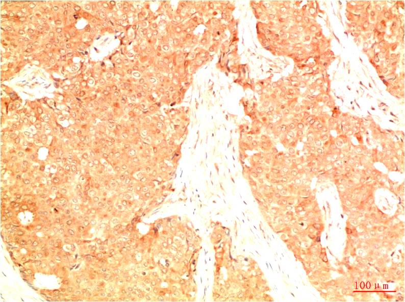 Acetyl-p53 (Lys382) (2G4) Mouse Monoclonal Antibody