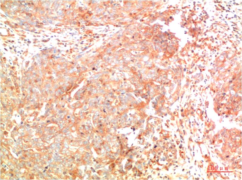 ATG7 (1F8) Mouse Monoclonal Antibody