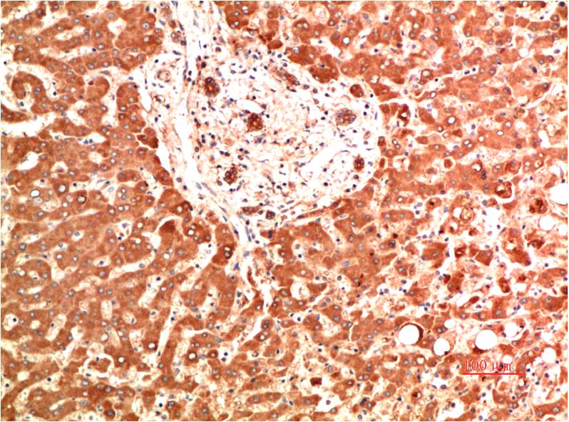 Collagen IV alpha 1 (2G3) Mouse Monoclonal Antibody
