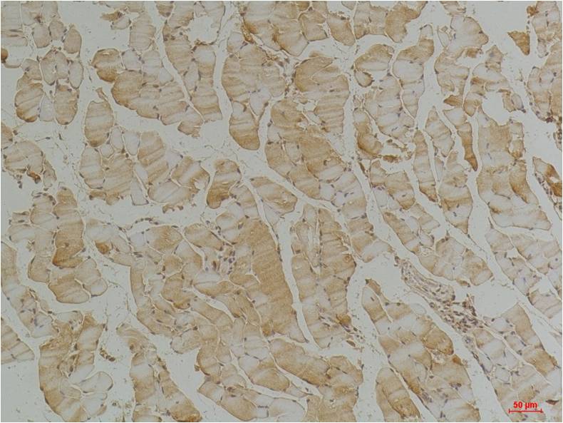 Desmin (4H1) Mouse Monoclonal Antibody