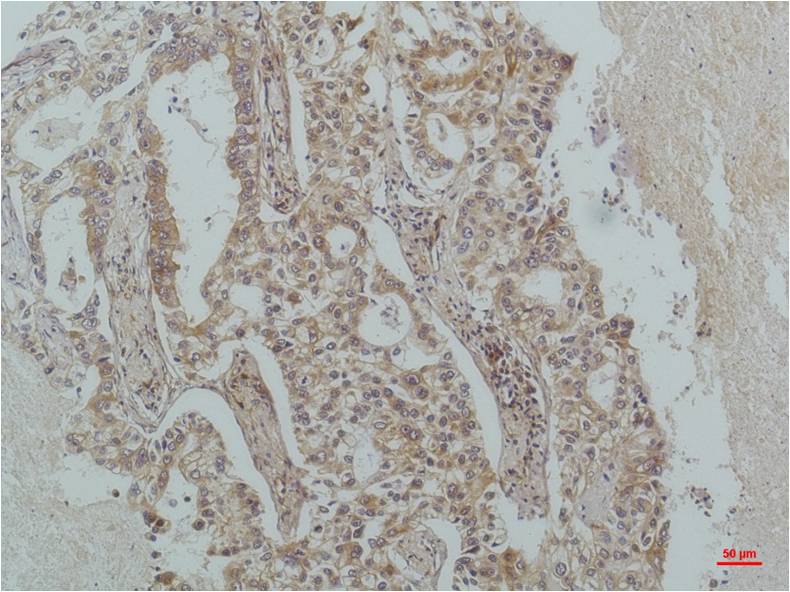 IKB beta (3H3) Mouse Monoclonal Antibody
