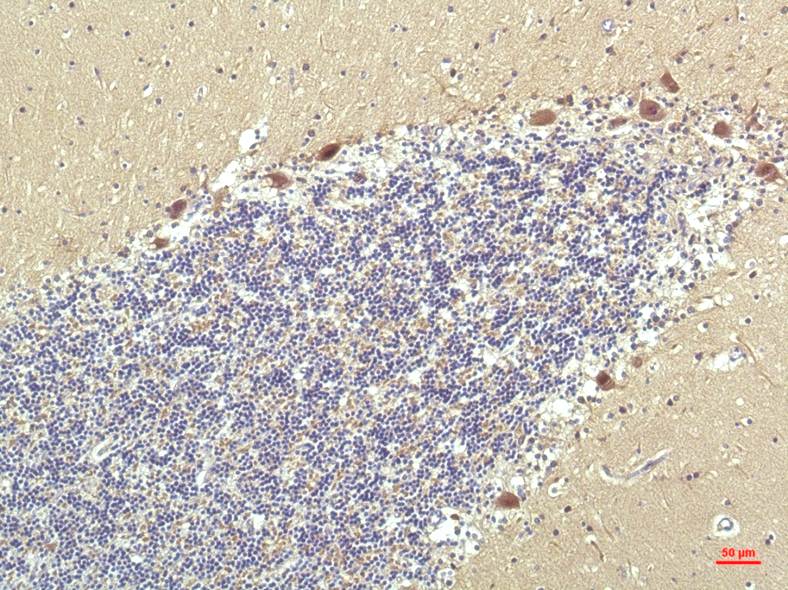 PPAR delta (4G5) Mouse Monoclonal Antibody