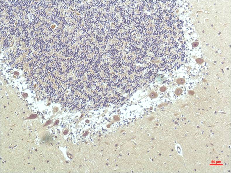 PPAR delta (4F4) Mouse Monoclonal Antibody