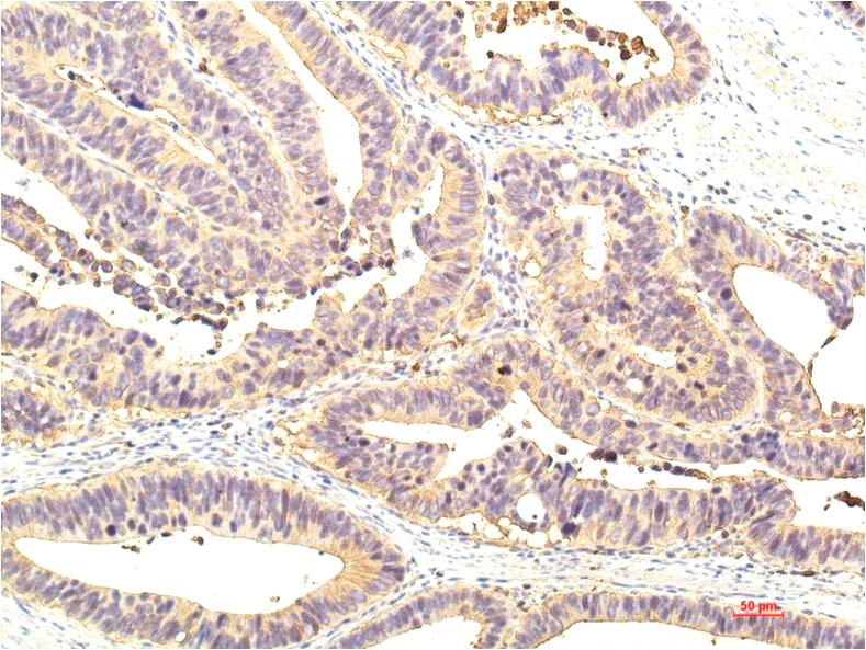 STAT1 (10F1) Mouse Monoclonal Antibody