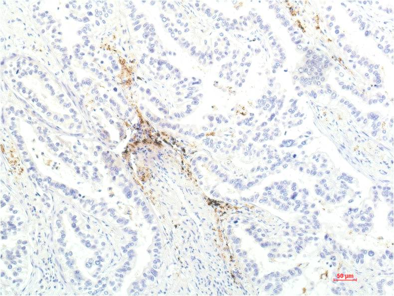 JAK1 (8D8) Mouse Monoclonal Antibody