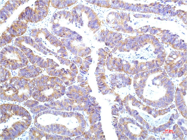 STAT1 (9G8) Mouse Monoclonal Antibody