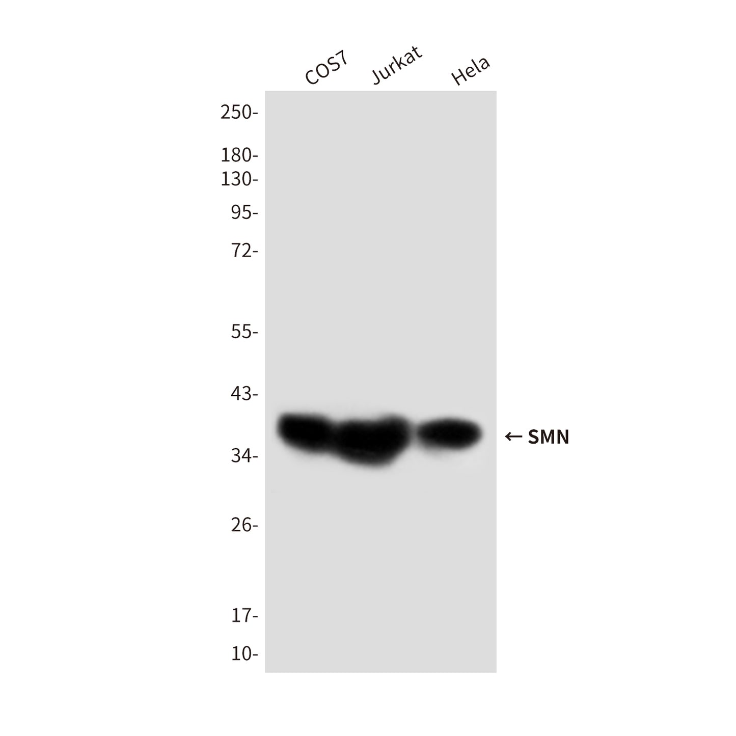 SMN (2F1) Mouse Monoclonal Antibody