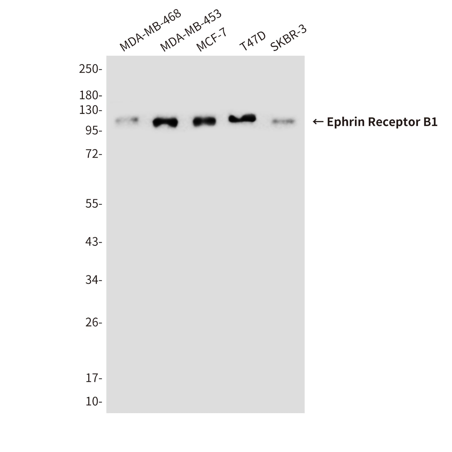 Ephrin Receptor B1 (9B4) Mouse Monoclonal Antibody