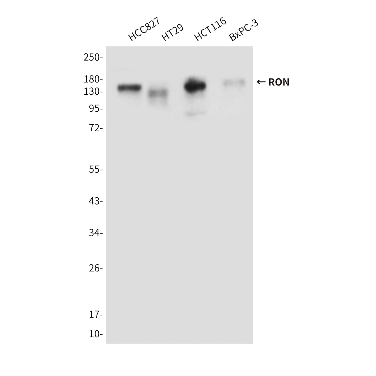 RON (9B6) Mouse Monoclonal Antibody