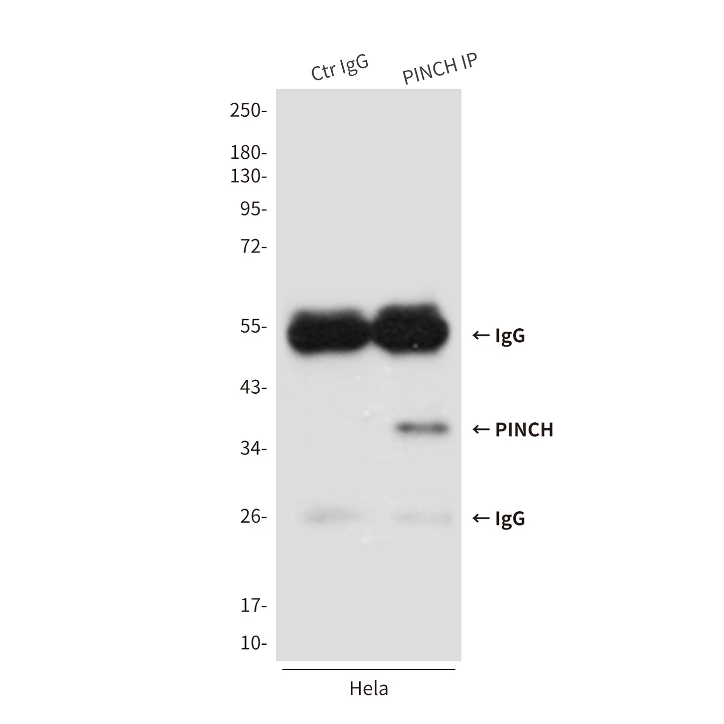 PINCH (3C12) Mouse Monoclonal Antibody