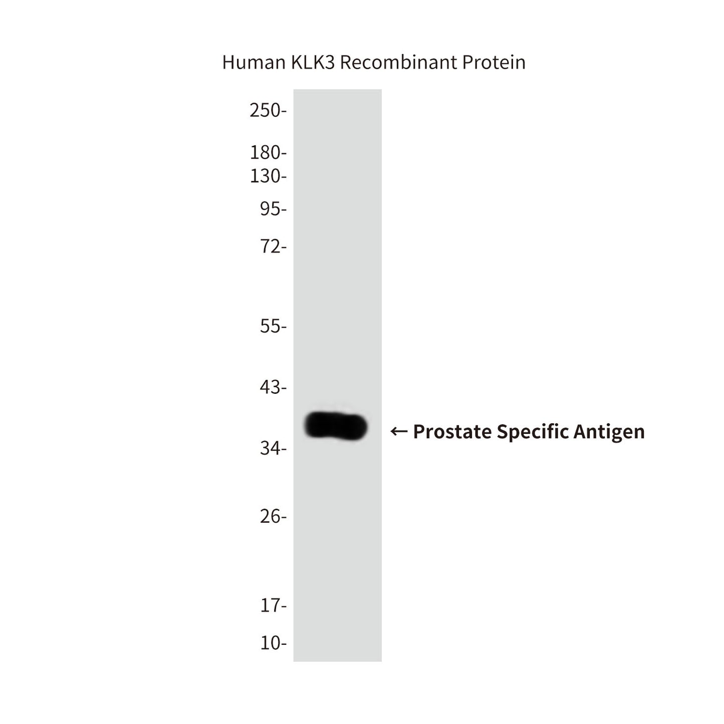 Prostate Specific Antigen Mouse Monoclonal Antibody